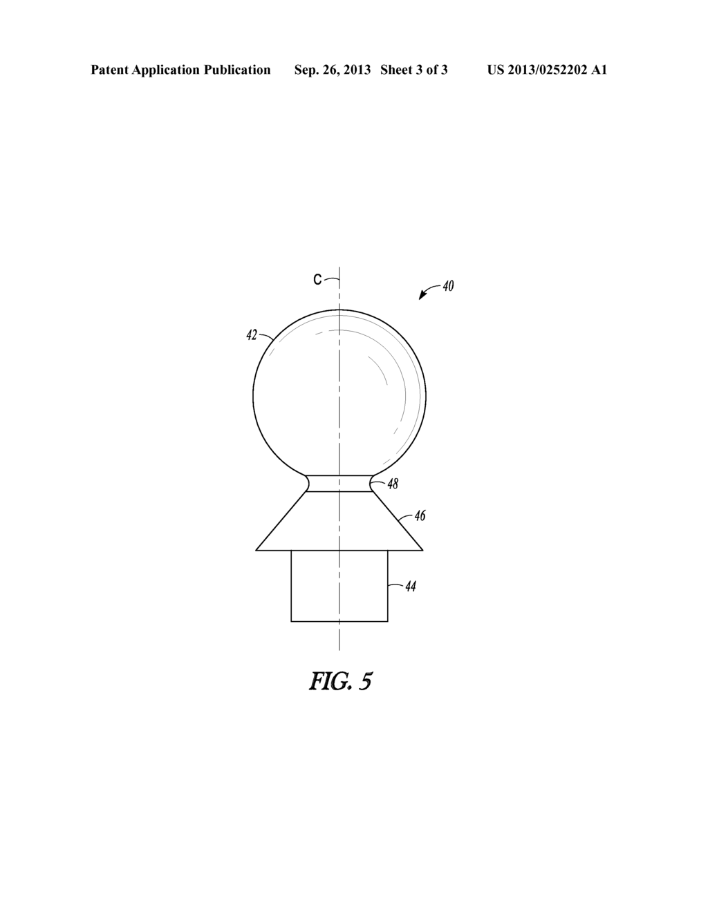 METHOD FOR PLANNING A DENTAL PROSTHESIS IMPLANT ARRANGEMENT AND A     REFERENCE ARRANGEMENT - diagram, schematic, and image 04