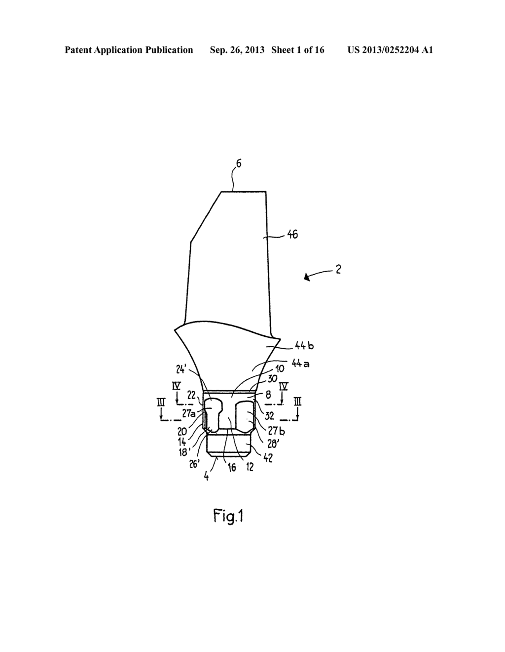 ABUTMENT FOR A DENTAL IMPLANT - diagram, schematic, and image 02