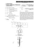 DENTAL IMPLANT SYSTEM diagram and image