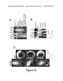 DRG11-RESPONSIVE (DRAGON) GENE AND USES THEREOF diagram and image