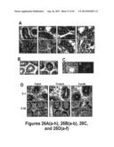 DRG11-RESPONSIVE (DRAGON) GENE AND USES THEREOF diagram and image