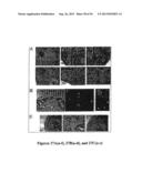 DRG11-RESPONSIVE (DRAGON) GENE AND USES THEREOF diagram and image