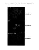 Endoplasmic Reticulum Localization Signals diagram and image