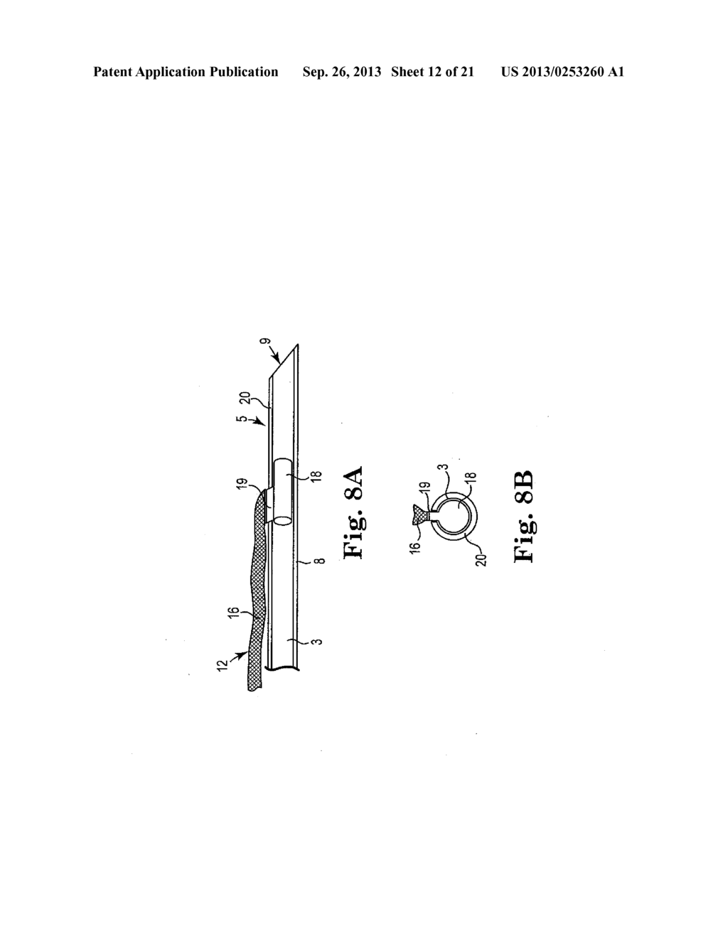 SURGICAL TOOLS, SYSTEMS, AND RELATED IMPLANTS AND METHODS - diagram, schematic, and image 13