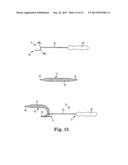 SURGICAL TOOLS, SYSTEMS, AND RELATED IMPLANTS AND METHODS diagram and image