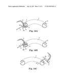 SURGICAL TOOLS, SYSTEMS, AND RELATED IMPLANTS AND METHODS diagram and image