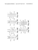 SURGICAL TOOLS, SYSTEMS, AND RELATED IMPLANTS AND METHODS diagram and image