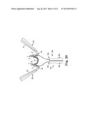 SURGICAL TOOLS, SYSTEMS, AND RELATED IMPLANTS AND METHODS diagram and image