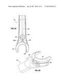 IMPLANTABLE ACCESS PORT SYSTEM diagram and image