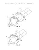 IMPLANTABLE ACCESS PORT SYSTEM diagram and image