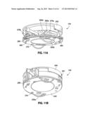 IMPLANTABLE ACCESS PORT SYSTEM diagram and image