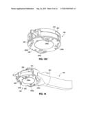 IMPLANTABLE ACCESS PORT SYSTEM diagram and image