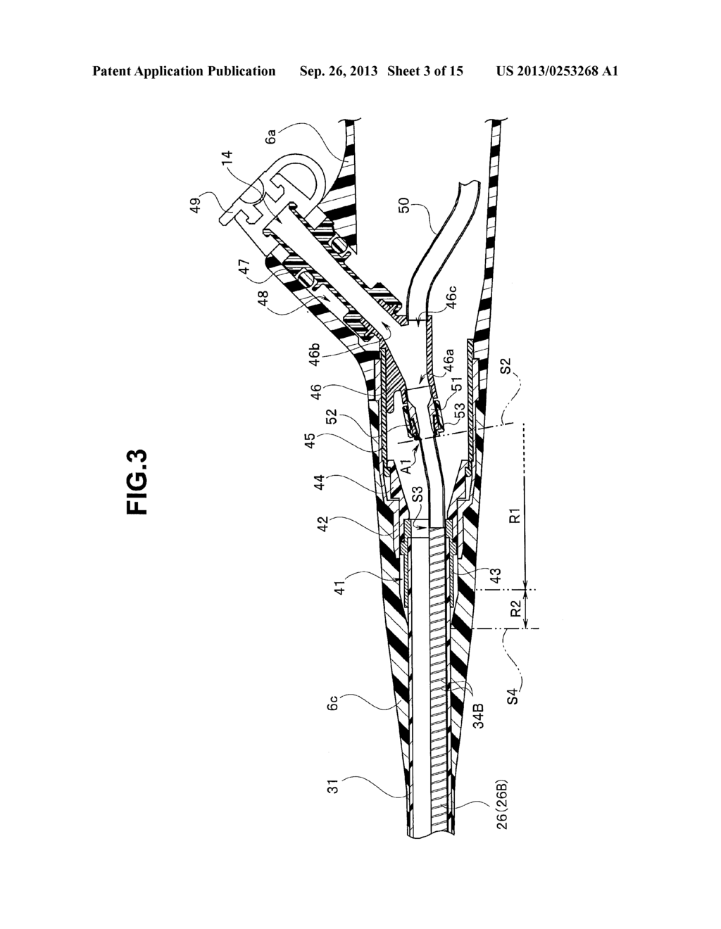 RESIN TUBE AND ENDOSCOPE - diagram, schematic, and image 04