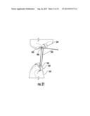 Tissue Retractor Assembly diagram and image