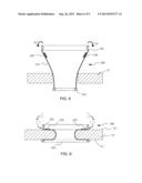 SURGICAL ACCESS ASSEMBLY AND METHOD OF USE THEREFOR diagram and image