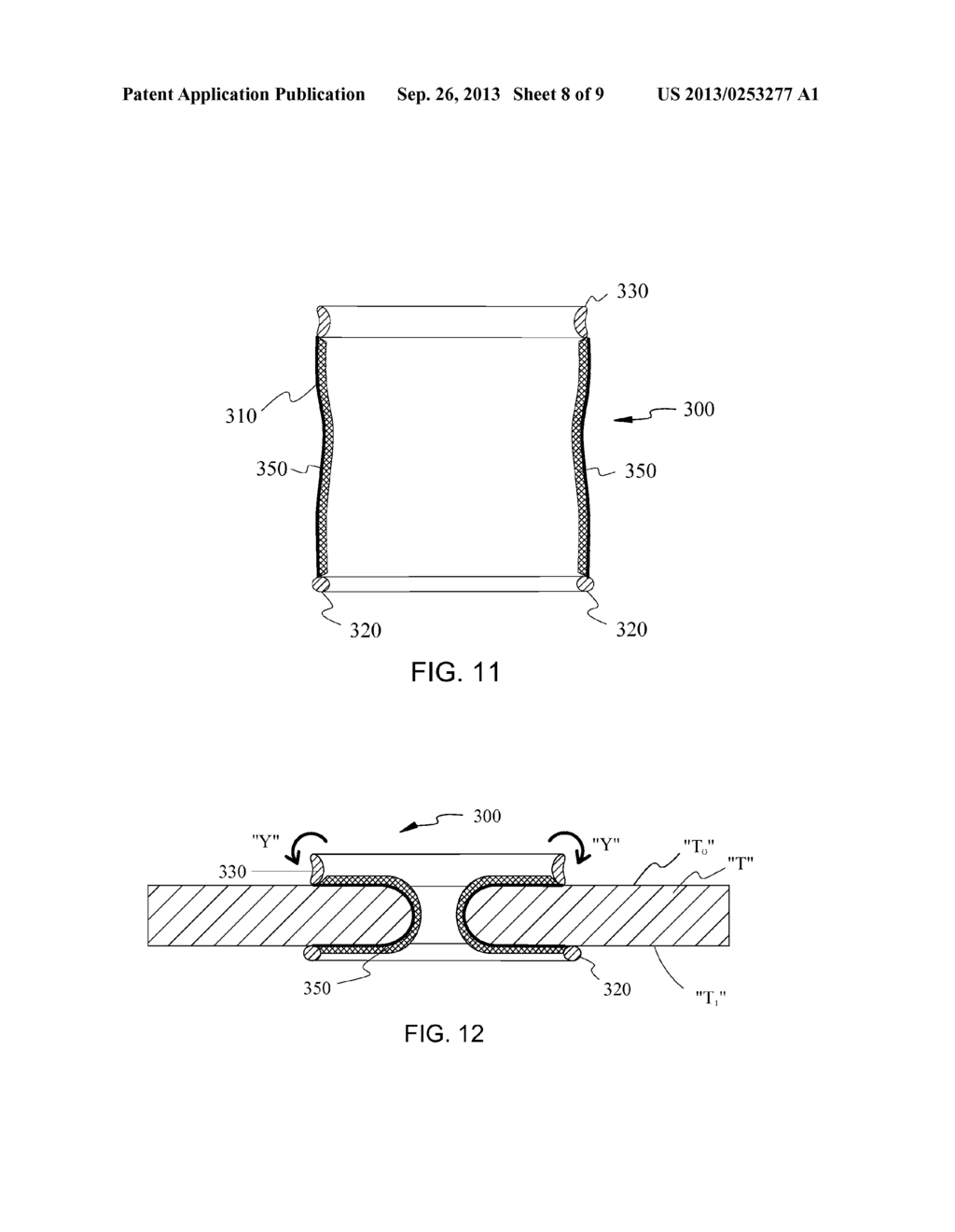 SURGICAL ACCESS ASSEMBLY AND METHOD OF USE THEREFOR - diagram, schematic, and image 09