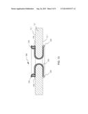 SURGICAL ACCESS ASSEMBLY AND METHOD OF USE THEREFOR diagram and image