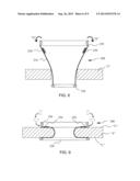 SURGICAL ACCESS ASSEMBLY AND METHOD OF USE THEREFOR diagram and image