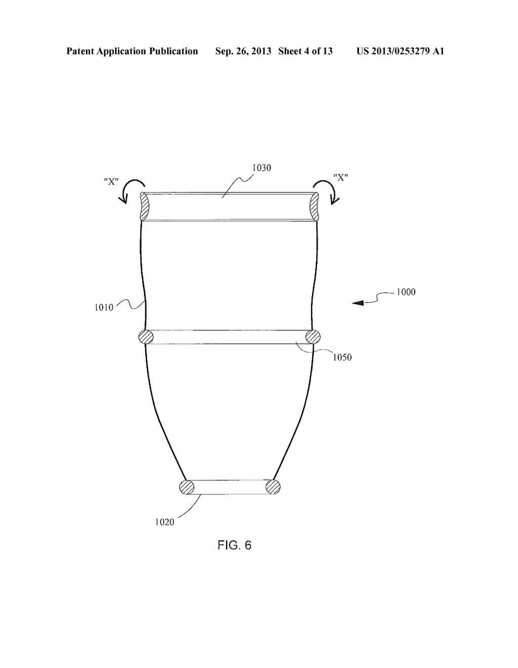 SURGICAL ACCESS ASSEMBLY AND METHOD OF USE THEREFOR - diagram, schematic, and image 05