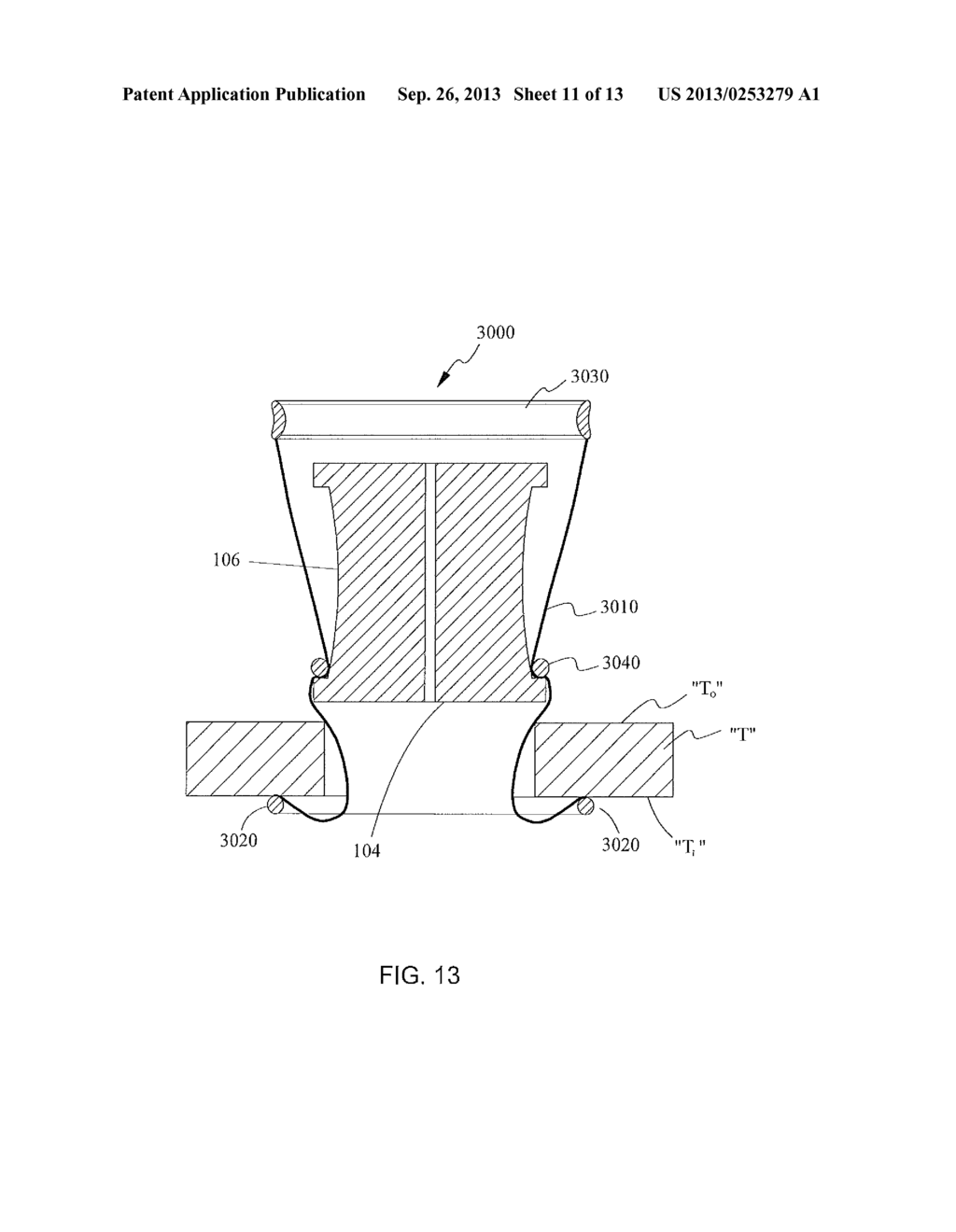 SURGICAL ACCESS ASSEMBLY AND METHOD OF USE THEREFOR - diagram, schematic, and image 12