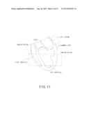 MAGNETIC RESONANCE IMAGING APPARATUS AND MAGNETIC RESONANCE IMAGING METHOD diagram and image