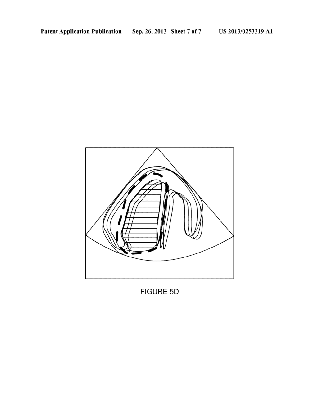 METHOD AND SYSTEM FOR ACQUIRING AND ANALYZING MULTIPLE IMAGE DATA LOOPS - diagram, schematic, and image 08