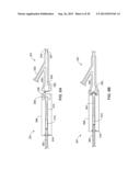 IMPLANTABLE MEDICAL DEVICE DELIVERY CATHETER WITH TETHER diagram and image