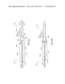 PASS-THROUGH IMPLANTABLE MEDICAL DEVICE DELIVERY CATHETER WITH REMOVEABLE     DISTAL TIP diagram and image