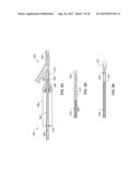 PASS-THROUGH IMPLANTABLE MEDICAL DEVICE DELIVERY CATHETER WITH REMOVEABLE     DISTAL TIP diagram and image