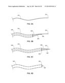 PASS-THROUGH IMPLANTABLE MEDICAL DEVICE DELIVERY CATHETER WITH REMOVEABLE     DISTAL TIP diagram and image