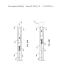 PASS-THROUGH IMPLANTABLE MEDICAL DEVICE DELIVERY CATHETER WITH REMOVEABLE     DISTAL TIP diagram and image