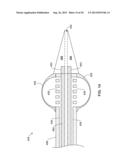 PASS-THROUGH IMPLANTABLE MEDICAL DEVICE DELIVERY CATHETER WITH REMOVEABLE     DISTAL TIP diagram and image