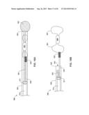 PASS-THROUGH IMPLANTABLE MEDICAL DEVICE DELIVERY CATHETER WITH REMOVEABLE     DISTAL TIP diagram and image