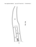 PASS-THROUGH IMPLANTABLE MEDICAL DEVICE DELIVERY CATHETER WITH REMOVEABLE     DISTAL TIP diagram and image