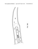 PASS-THROUGH IMPLANTABLE MEDICAL DEVICE DELIVERY CATHETER WITH REMOVEABLE     DISTAL TIP diagram and image