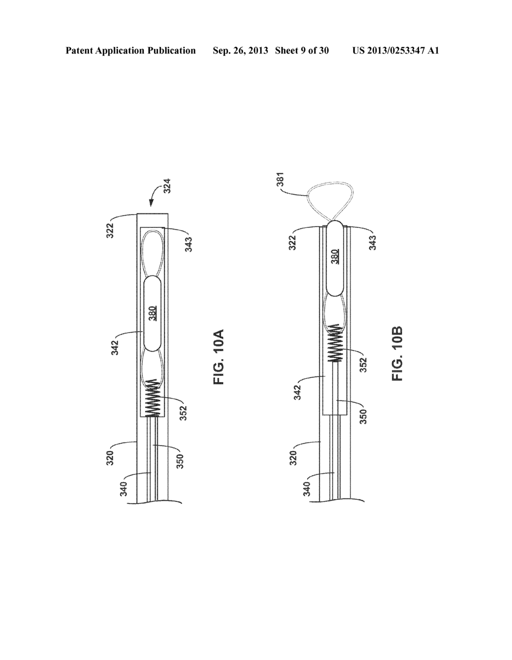 TETHERED IMPLANTABLE MEDICAL DEVICE DEPLOYMENT - diagram, schematic, and image 10