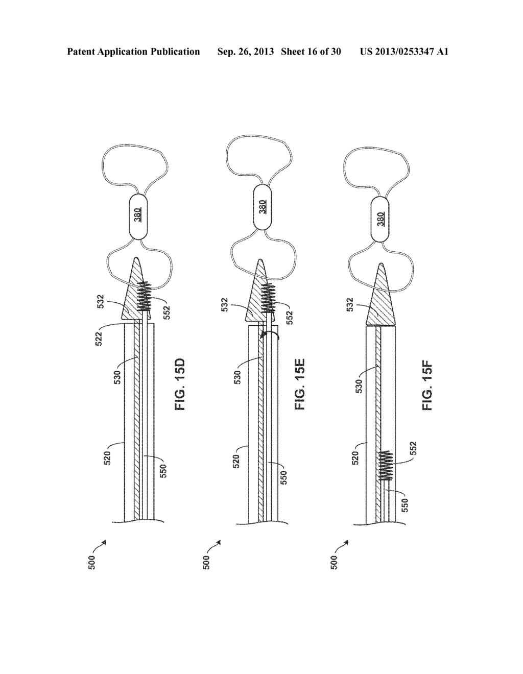 TETHERED IMPLANTABLE MEDICAL DEVICE DEPLOYMENT - diagram, schematic, and image 17