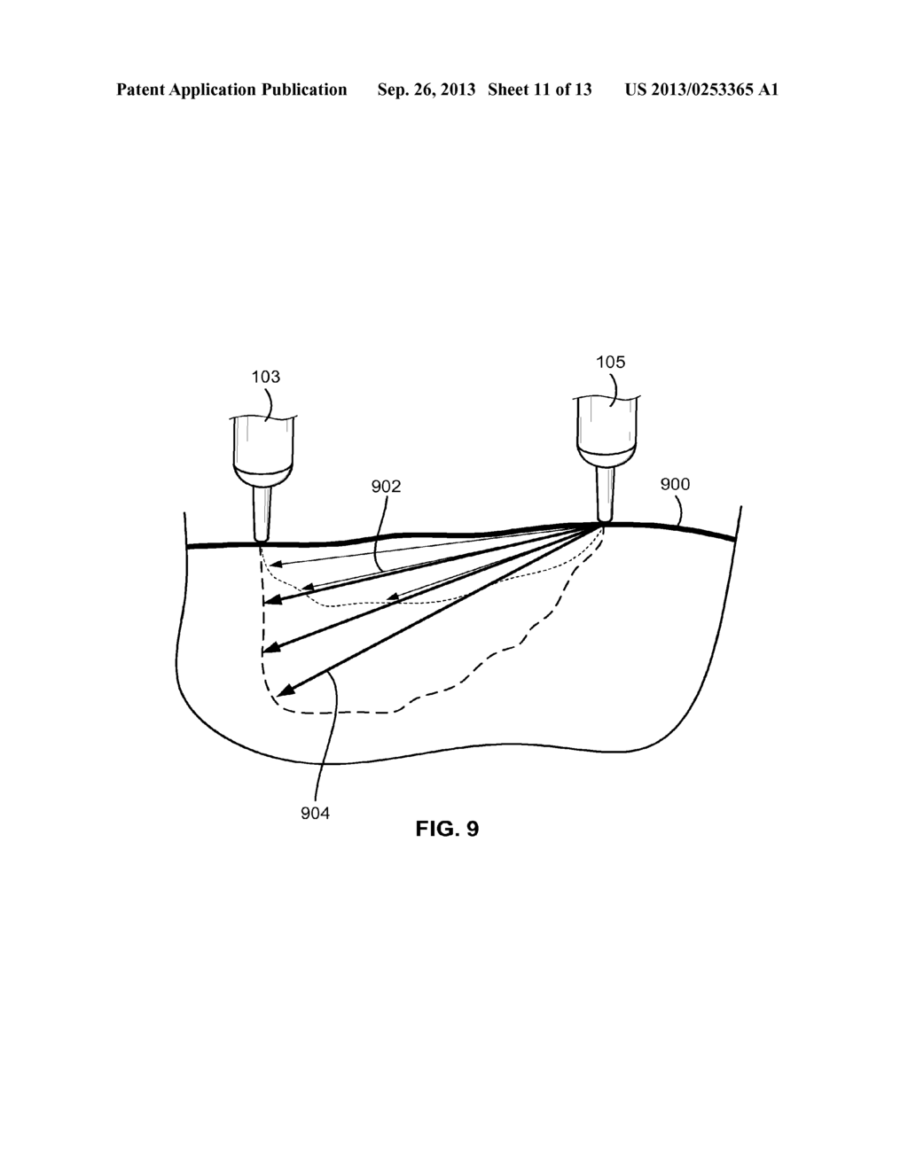 APPARATUS AND METHOD FOR TREATMENT OF PAIN WITH BODY IMPEDANCE ANALYZER - diagram, schematic, and image 12