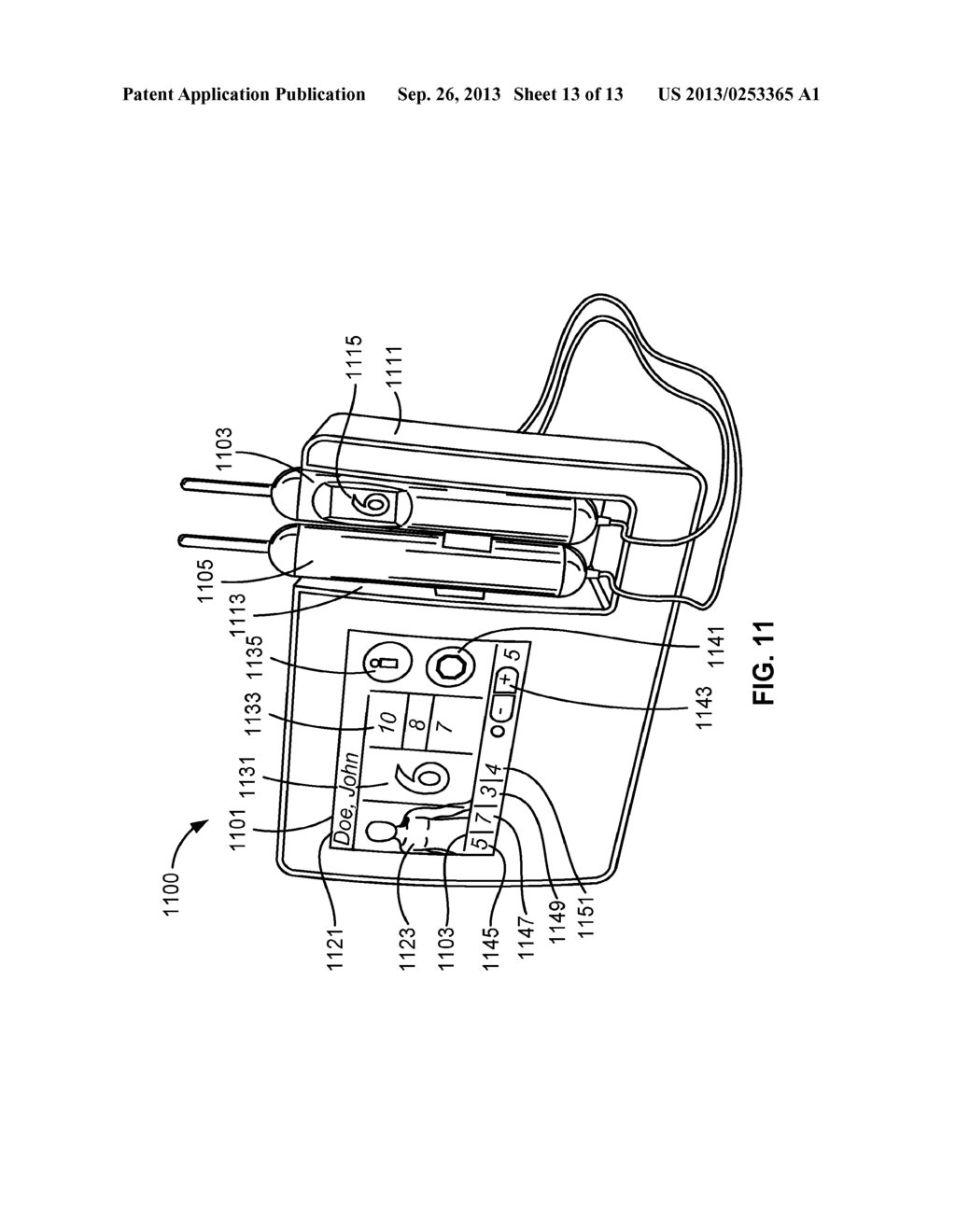 APPARATUS AND METHOD FOR TREATMENT OF PAIN WITH BODY IMPEDANCE ANALYZER - diagram, schematic, and image 14