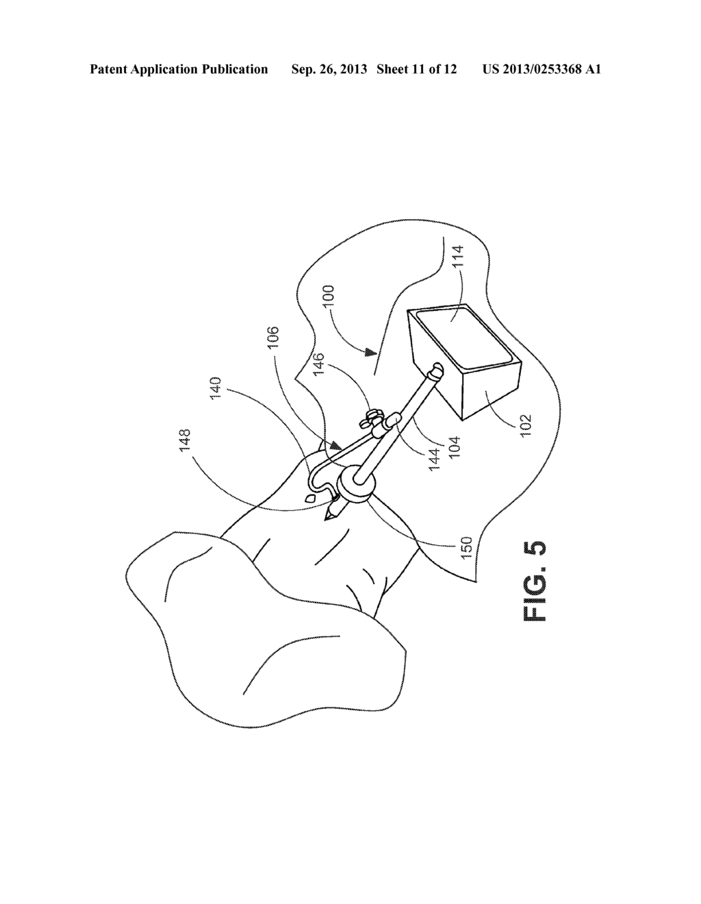 PORTABLE LAPAROSCOPE SYSTEM - diagram, schematic, and image 12