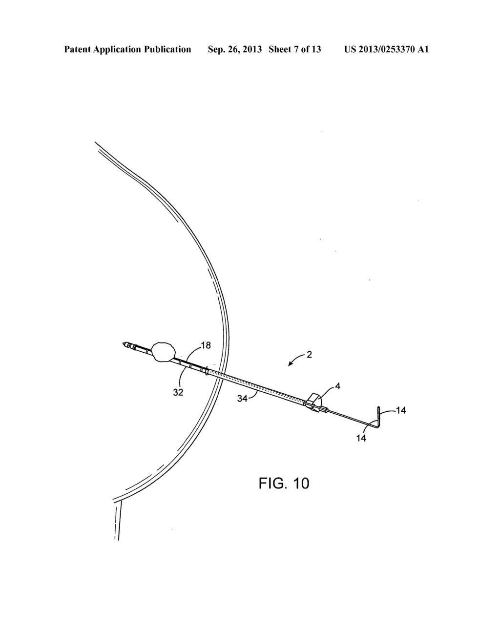 DEVICES AND METHODS FOR PERFORMING PROCEDURES ON A BREAST - diagram, schematic, and image 08