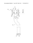 METHOD AND APPARATUS FOR PREVENTING VAGINAL LACERATIONS DURING CHILDBIRTH diagram and image