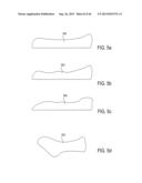 METHOD AND APPARATUS FOR PREVENTING VAGINAL LACERATIONS DURING CHILDBIRTH diagram and image