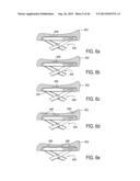 METHOD AND APPARATUS FOR PREVENTING VAGINAL LACERATIONS DURING CHILDBIRTH diagram and image