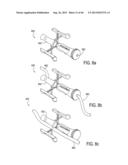 METHOD AND APPARATUS FOR PREVENTING VAGINAL LACERATIONS DURING CHILDBIRTH diagram and image