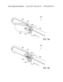 METHOD AND APPARATUS FOR PREVENTING VAGINAL LACERATIONS DURING CHILDBIRTH diagram and image