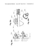 METHOD AND APPARATUS FOR PREVENTING VAGINAL LACERATIONS DURING CHILDBIRTH diagram and image