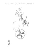 METHOD AND APPARATUS FOR PREVENTING VAGINAL LACERATIONS DURING CHILDBIRTH diagram and image