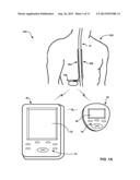 COLLECTING POSTURE INFORMATION TO EVALUATE THERAPY diagram and image