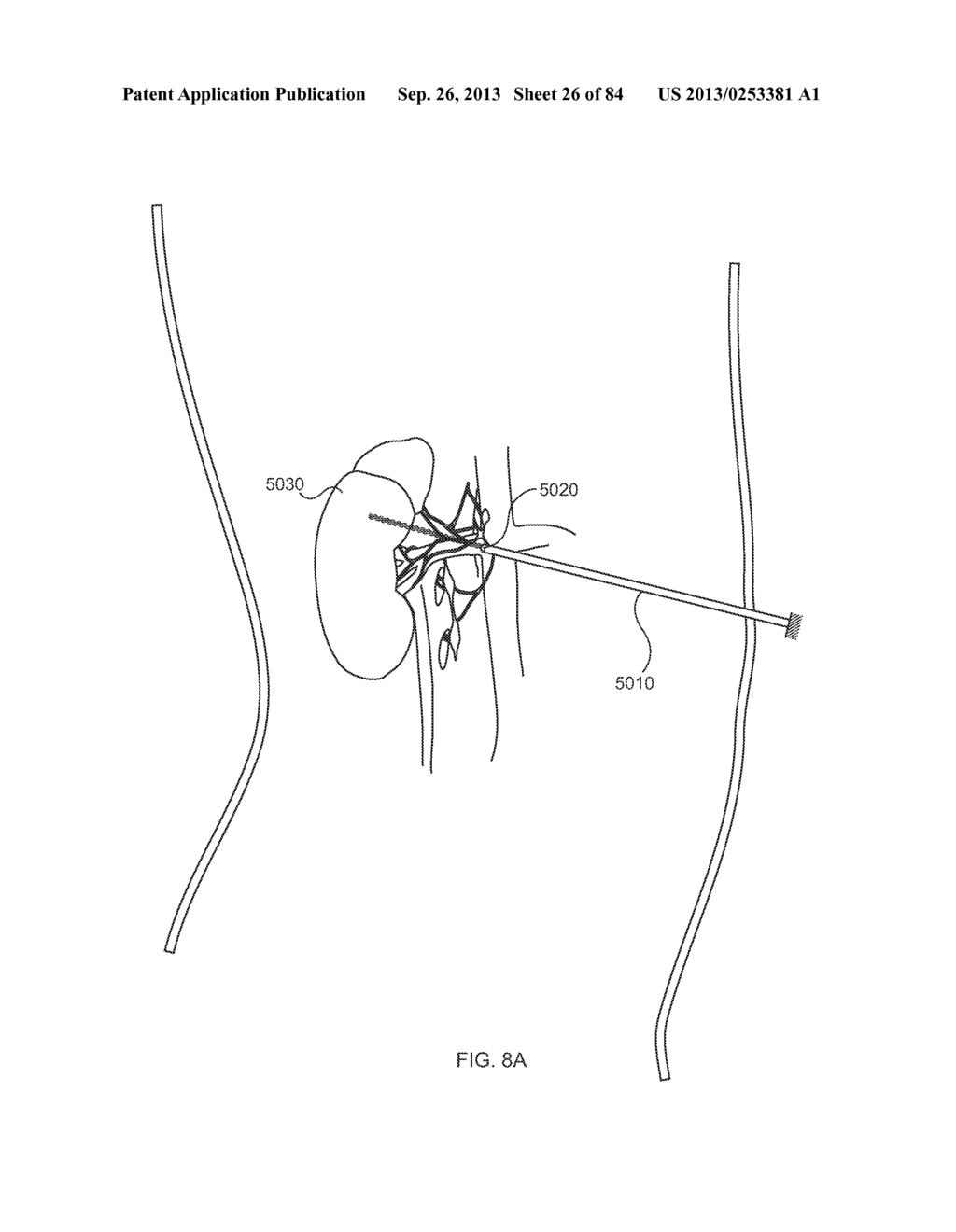 ENERGETIC MODULATION OF NERVES - diagram, schematic, and image 27